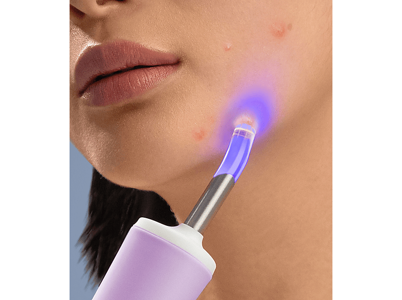 Tratamiento antiacné - Foreo ESPADA 2 Plus, Apagado automático, Lavanda